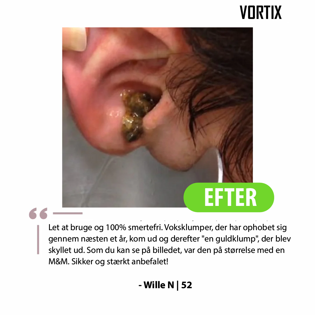 VORTIX sæt til fjernelse af ørevoks
