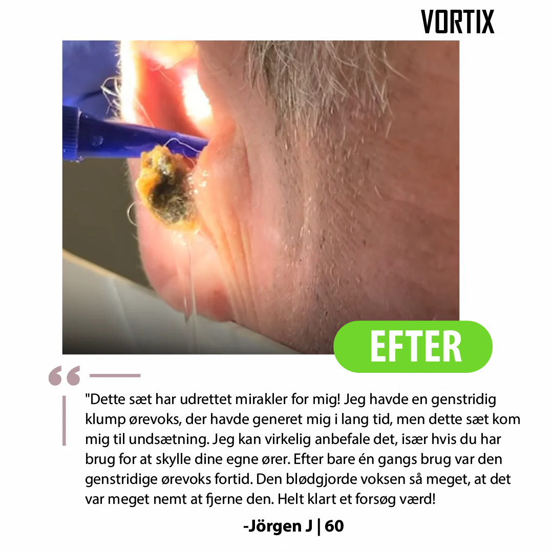 VORTIX sæt til fjernelse af ørevoks
